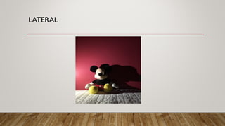 LATERAL
 