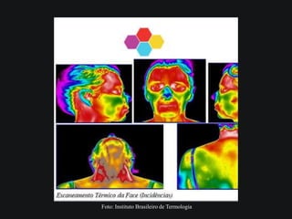 Foto: Instituto Brasileiro de Termologia
 