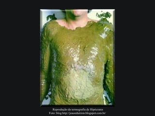 Reprodução da termografia de Hipócrates
Foto: blog http://joaoeduirion.blogspot.com.br/
 