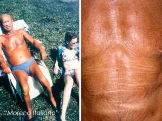 “Moreno Italiano”
 