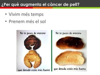 • Vivim més temps
• Prenem més el sol
¿Per què augmenta el càncer de pell?
 