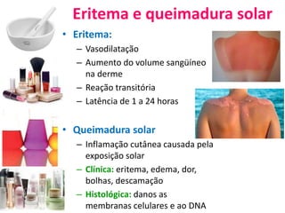 Eritema e queimadura solar
• Eritema:
– Vasodilatação
– Aumento do volume sangüíneo
na derme
– Reação transitória
– Latência de 1 a 24 horas
• Queimadura solar
– Inflamação cutânea causada pela
exposição solar
– Clínica: eritema, edema, dor,
bolhas, descamação
– Histológica: danos as
membranas celulares e ao DNA
 