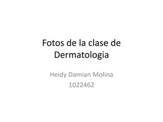 Fotos de la clase de
   Dermatologia
 Heidy Damian Molina
       1022462
 