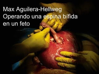 Max Aguilera-Hellweg Operando una espina bífida  en un feto 