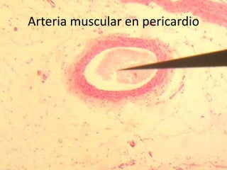 Arteria muscular en pericardio
 