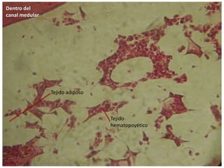 Tejido adiposo
Tejido
hematopoyético
Dentro del
canal medular
 