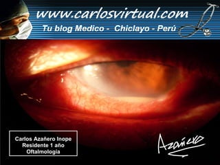 Carlos Azañero Inope Residente 1 año Oftalmología 
