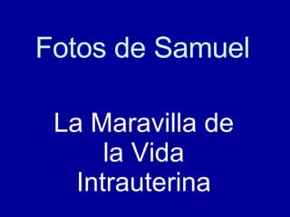 Fotos de Samuel La Maravilla de la Vida Intrauterina 