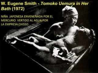 W. Eugene Smith -  Tomoko Uemura in Her Bath  (1972) NIÑA  JAPONESA ENVENENADA POR EL  MERCURIO  VERTIDO AL AGUA POR  LA EMPRESA CHISSO 