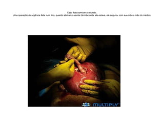 Essa foto comoveu o mundo. Uma operação de urgência feita num feto, quando abriram o ventre da mãe onde ele estava, ele segurou com sua mão a mão do médico. 