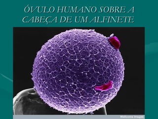 ÓVULO HUMANO SOBRE A CABEÇA DE UM ALFINETE  