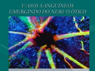 VASOS SANGUINEOS EMERGINDO DO NERVO ÓTICO 