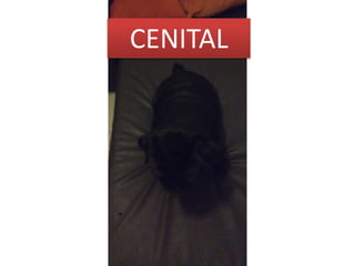 CENITAL
 