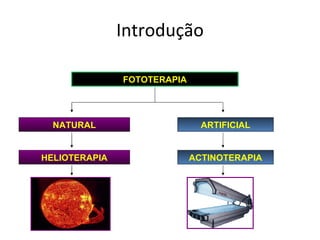 Introdução FOTOTERAPIA ARTIFICIAL NATURAL ACTINOTERAPIA HELIOTERAPIA 