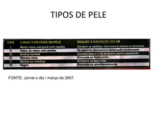 TIPOS DE PELE FONTE: Jornal o dia / março de 2007. 