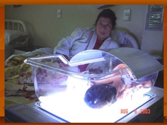 FOTOTERAPIA NEONATAL EBOOK DOWNLOAD : Me Recommends