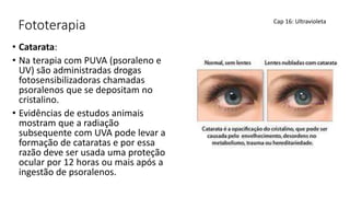 Fototerapia
• Catarata:
• Na terapia com PUVA (psoraleno e
UV) são administradas drogas
fotosensibilizadoras chamadas
psoralenos que se depositam no
cristalino.
• Evidências de estudos animais
mostram que a radiação
subsequente com UVA pode levar a
formação de cataratas e por essa
razão deve ser usada uma proteção
ocular por 12 horas ou mais após a
ingestão de psoralenos.
Cap 16: Ultravioleta
 