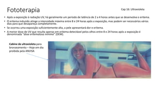 Fototerapia
• Após a exposição à radiação UV, há geralmente um período de latência de 2 a 4 horas antes que se desenvolva o eritema.
• O eritema induzido atinge a intensidade máxima entre 8 e 24 horas após a exposição, mas podem ser necessários vários
dias para que desapareça completamente.
• Se ocorreu uma exposição suficientemente alta, a pele apresentará dor e eritema.
• A menor dose de UV que resulta apenas em eritema detectável pelos olhos entre 8 e 24 horas após a exposição é
denominada “dose eritematosa mínima” (DEM).
Cap 16: Ultravioleta
Cabine de ultravioleta para
bronzeamento – Hoje em dia
proibida pela ANVISA
 