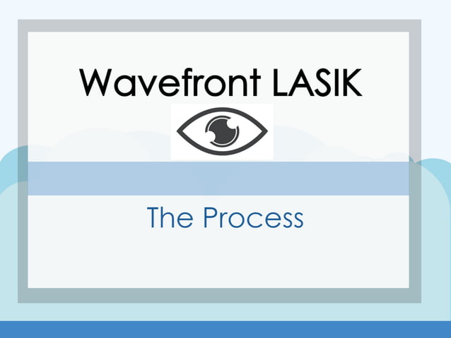 Wavefront LASIK: The Process | PDF