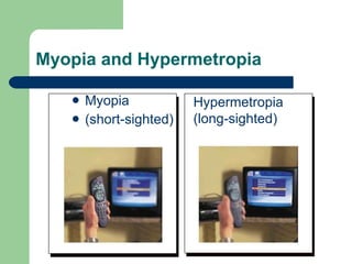 Myopia and Hypermetropia Myopia (short-sighted) Hypermetropia (long-sighted) 