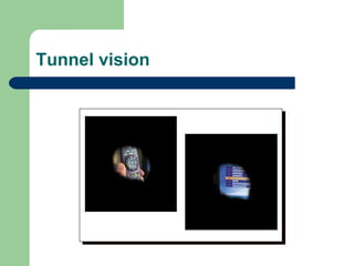 Tunnel vision 