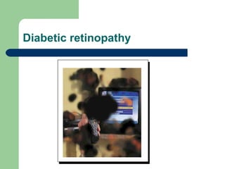 Diabetic retinopathy 
