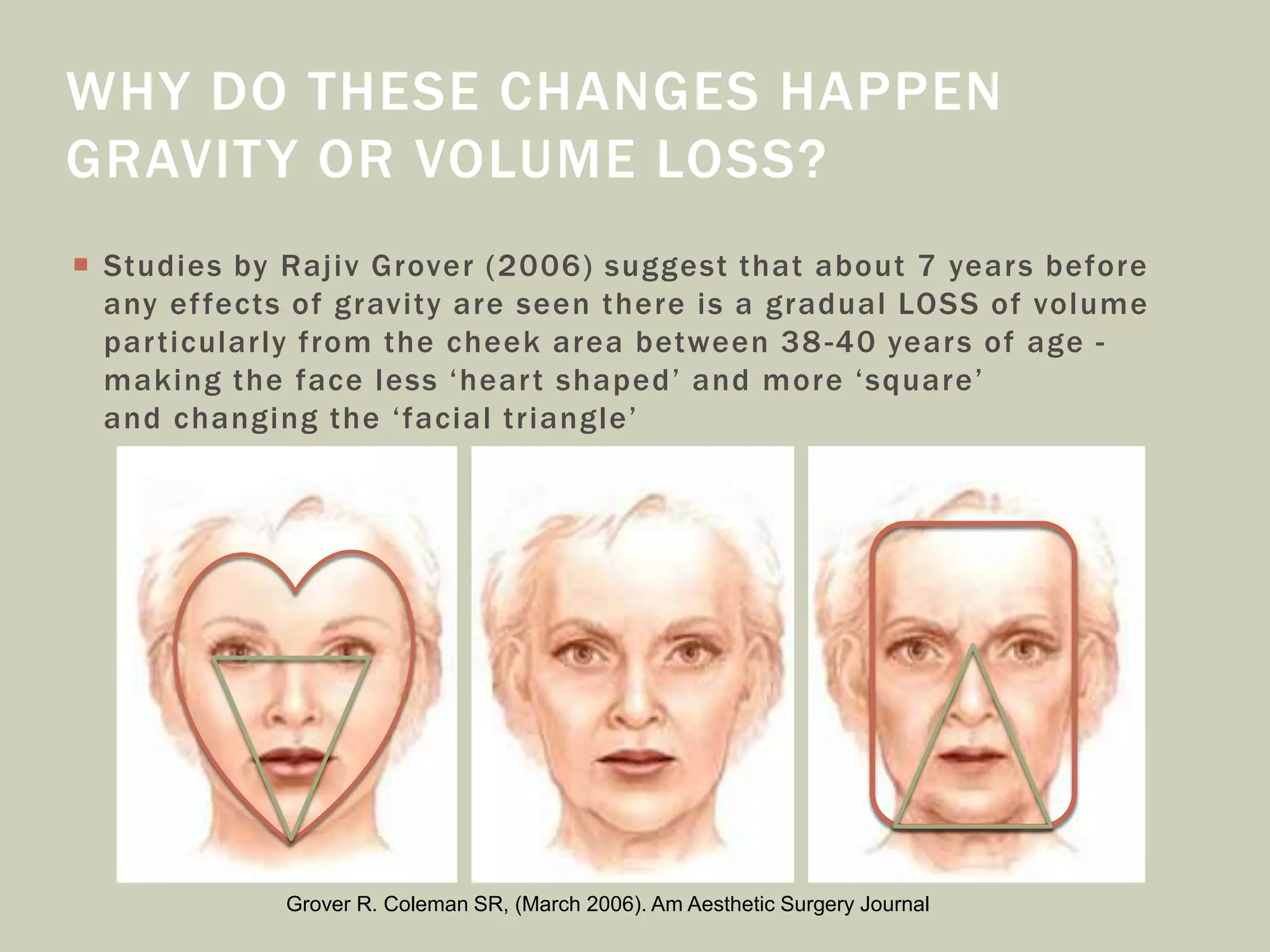  Studies by Rajiv Grover (2006) suggest that about 7 years before
any effects of gravity are seen there is a gradual LOSS of volume
particularly from the cheek area between 38-40 years of age -
making the face less ‘heart shaped’ and more ‘square’
and changing the ‘facial triangle’
WHY DO THESE CHANGES HAPPEN
GRAVITY OR VOLUME LOSS?
Grover R. Coleman SR, (March 2006). Am Aesthetic Surgery Journal
 