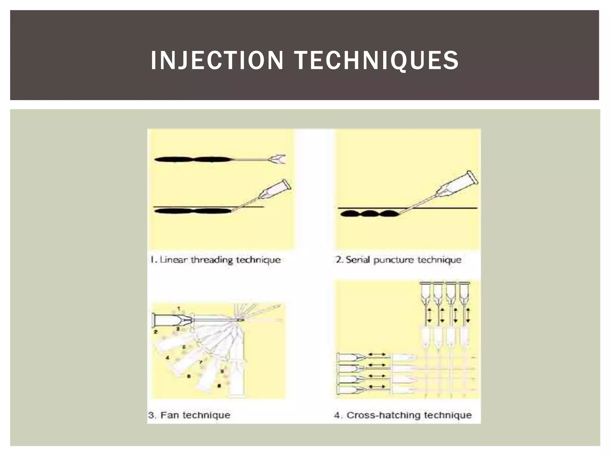 INJECTION TECHNIQUES
 