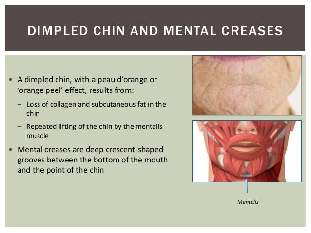 foundation course in dermal fillers hf