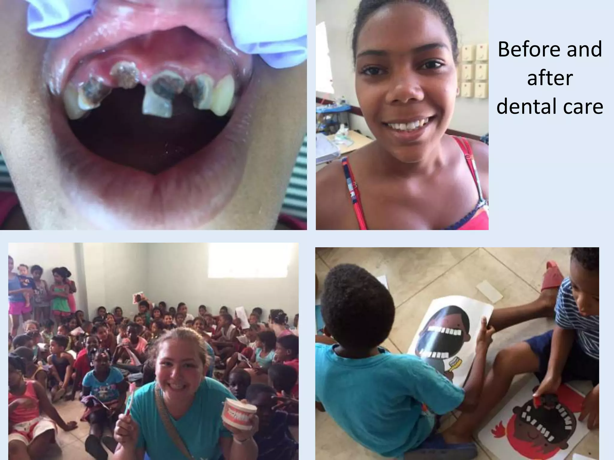 Before and
after
dental care
 