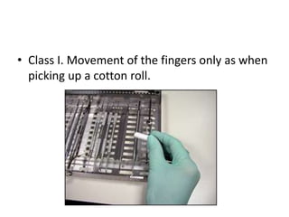 • Class I. Movement of the fingers only as when
picking up a cotton roll.
 