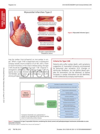 Fourth universal definition of myocardial | PDF