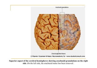 Superior aspect of the cerebral hemispheres showing arachnoid granulations on the right
               side .On the left side, the arachnoid mater has been removed .
 