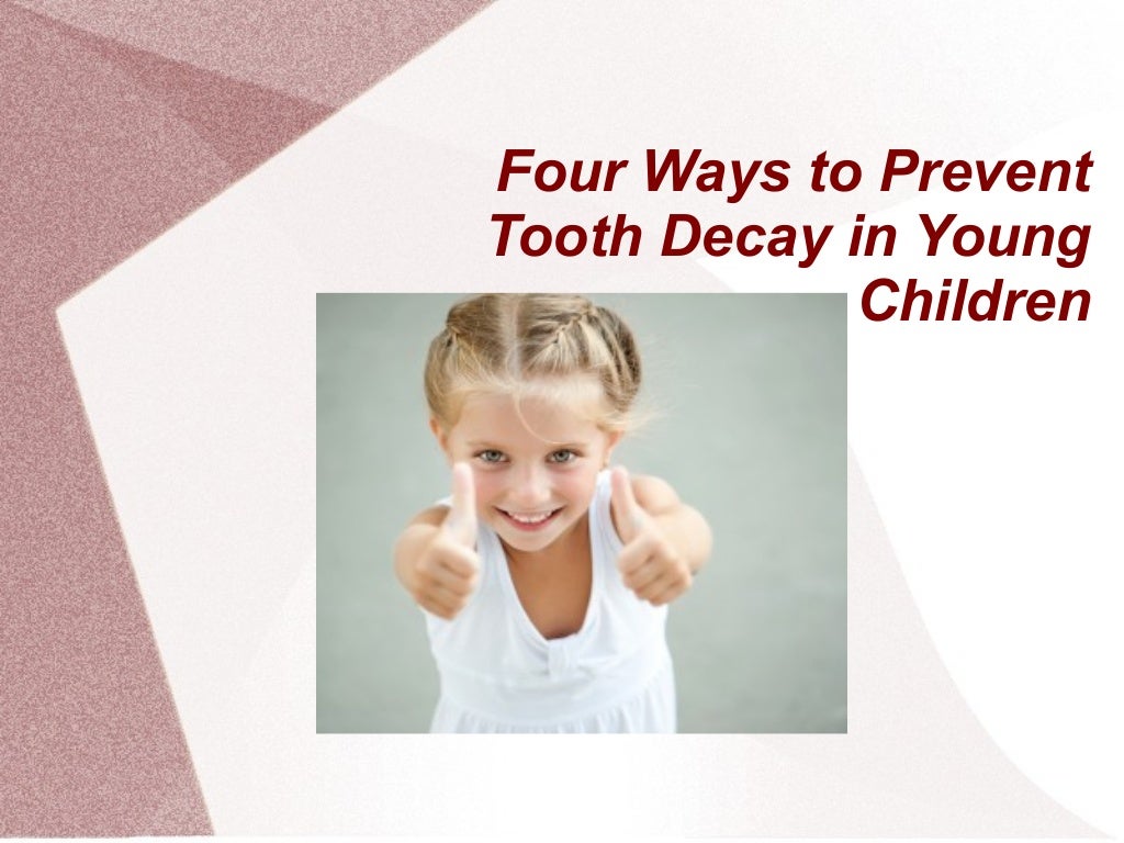 Four Ways to Prevent Tooth Decay in Young Children