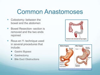 Common Anastomoses
 Colostomy- between the
  bowel and the abdomen
 Bowel Resection- section is
  removed and the two ends
  rejoined
 Roux-en Y- technique used
  in several procedures that
  include:
   Gastric Bypass
   Gastrectomy
   Bile Duct Obstructions
 