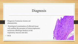 Diagnosis
• Diagnosis Cutaneous lesions are
characteristic.
• Histological examination of affected tissue
will confirm the presence of intracytoplasmic
inclusions (Bollinger bodies) in the
respiratory mucosa and skin.
• PCR
 