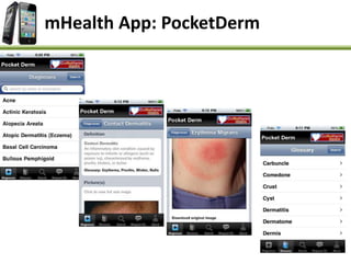 mHealth App: PocketDerm
 