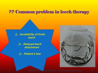 ?? Common problem in leech therapy
16
ENDOSURG-2019 AIIMS NEW DELHI – Leech Therapy Dr Mahesh Kumar
 . Availability of fresh
leech
 . Delayed leech
attachment
 . Patient’s fear
 