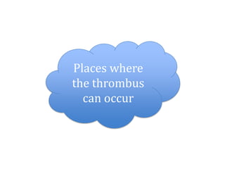 Places where
the thrombus
can occur
 