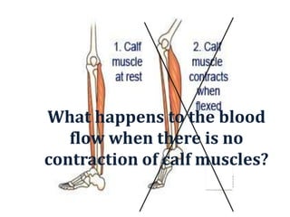 What happens to the blood
flow when there is no
contraction of calf muscles?
 