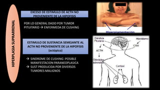 EXCESO DE ESTIMULO DE ACTH NO
PROVENIENTE DE LA HIPOFISIS
HIPERPLASIASUPRARRENAL
POR LO GENERAL DADO POR TUMOR
PITUITARIO  ENFERMEDA DE CUSHING
ESTIMULO DE SUSTANCIA SEMEJANTE AL
ACTH NO PROVENIENTE DE LA HIPOFISIS
(ectópico)
 SINDROME DE CUSHING :POSIBLE
MANIFESTACION PARANEOPLASICA
 SUST PRODUCIDA POR DIVERSOS
TUMORES MALIGNOS
 