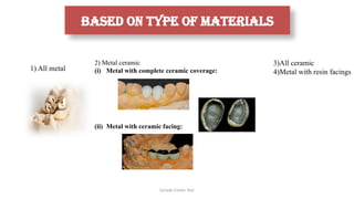 Sample Footer Text
based on type of materials
1) All metal
2) Metal ceramic
(i) Metal with complete ceramic coverage:
(ii) Metal with ceramic facing:
3)All ceramic
4)Metal with resin facings
 