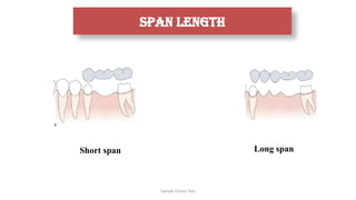 Sample Footer Text
Span length
Short span Long span
 