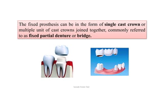 Sample Footer Text
The fixed prosthesis can be in the form of single cast crown or
multiple unit of cast crowns joined together, commonly referred
to as fixed partial denture or bridge.
 