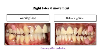 FPD ppt fixed partial denture case presentation format | PPTX