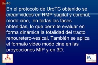 UroTC En el protocolo de UroTC obtenido se crean videos en RMP sagital y coronal,  modo cine,  en todas las fases obtenidas, lo que permite evaluar en forma dinámica la totalidad del tracto renouretero-vesical. También se aplica el formato video modo cine en las proyecciones MIP y en 3D. 