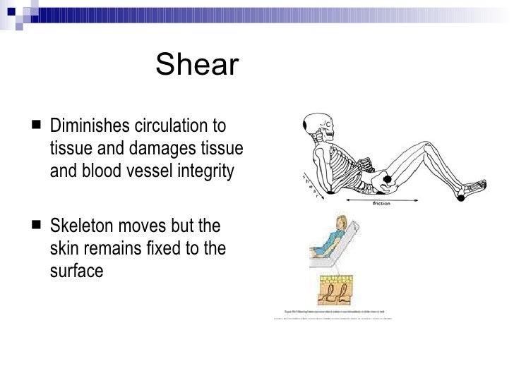 Wound management (SSKIN) Revision Cards in University Nursing
