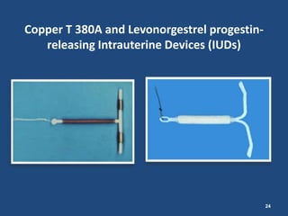 Copper T 380A and Levonorgestrel progestin-
   releasing Intrauterine Devices (IUDs)




                                              24
 
