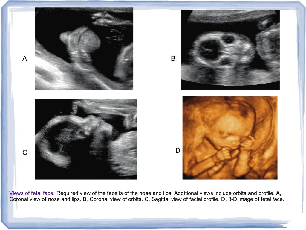 first trimester ultrasound and overview of obs imaging