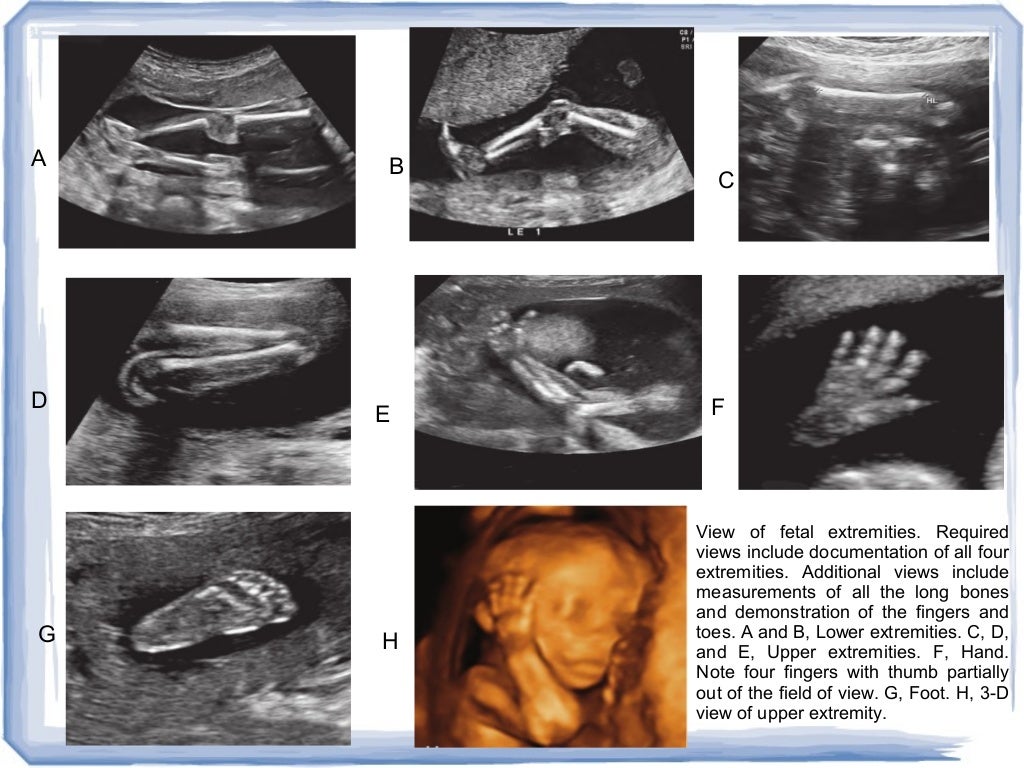 first trimester ultrasound and overview of obs imaging